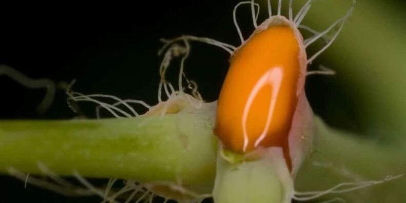 suc de celandină pentru tratamentul ciupercii unghiilor de la picioare